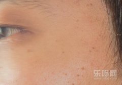 马齿苋敷脸有何功效,马齿苋敷脸有什么好处,马齿苋洗脸的功效