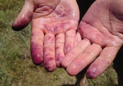 桑葚掉色正常吗,桑葚会掉色吗,桑葚为什么会掉色