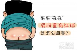 大便后肛门火辣辣的疼是什么原因,便后肛门灼热疼痛怎么回事