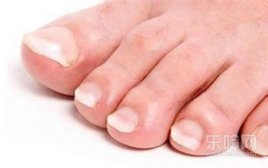 脚趾甲变厚是什么原因,脚趾甲为什么会变厚,脚趾甲变厚怎么回事