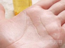 手心热是什么原因,手心热是怎么回事,手心发热是怎么回事