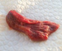 经血中有血块和烂肉状东西是怎么回事,经血中有烂肉状东西图片