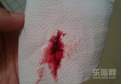 月经期间有血块是什么原因,月经期间有血块是什么原因,月经期间血