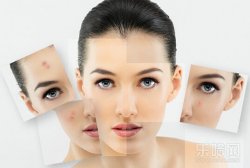 红霉素软膏可以祛痘吗,红霉素软膏的作用对痘痘有什么用,红霉素软