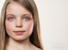 天热脸红怎么回事,为什么天热时脸通红,天一热脸就特别红