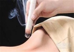 荨麻疹可以艾灸吗,荨麻疹能艾灸吗,艾灸能不能艾灸