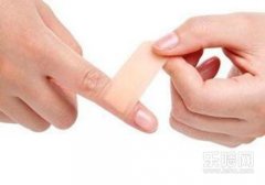 手指出血怎么快速止血,手指出血怎么止血,手指出血了怎么办