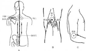 感冒的针灸拔罐疗法