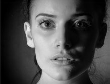 激光祛痣的适用人群 快看看你适合它吗