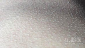 磨砂膏能去鸡皮肤吗,磨砂膏可以去鸡皮吗