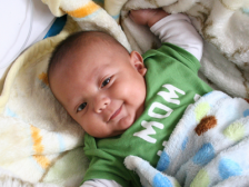 小儿湿疹的预防与护理